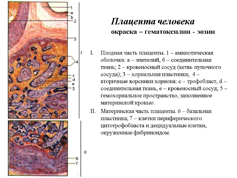 Плацента человека  окраска – гематоксилин - эозин   Плодная часть плаценты. 1